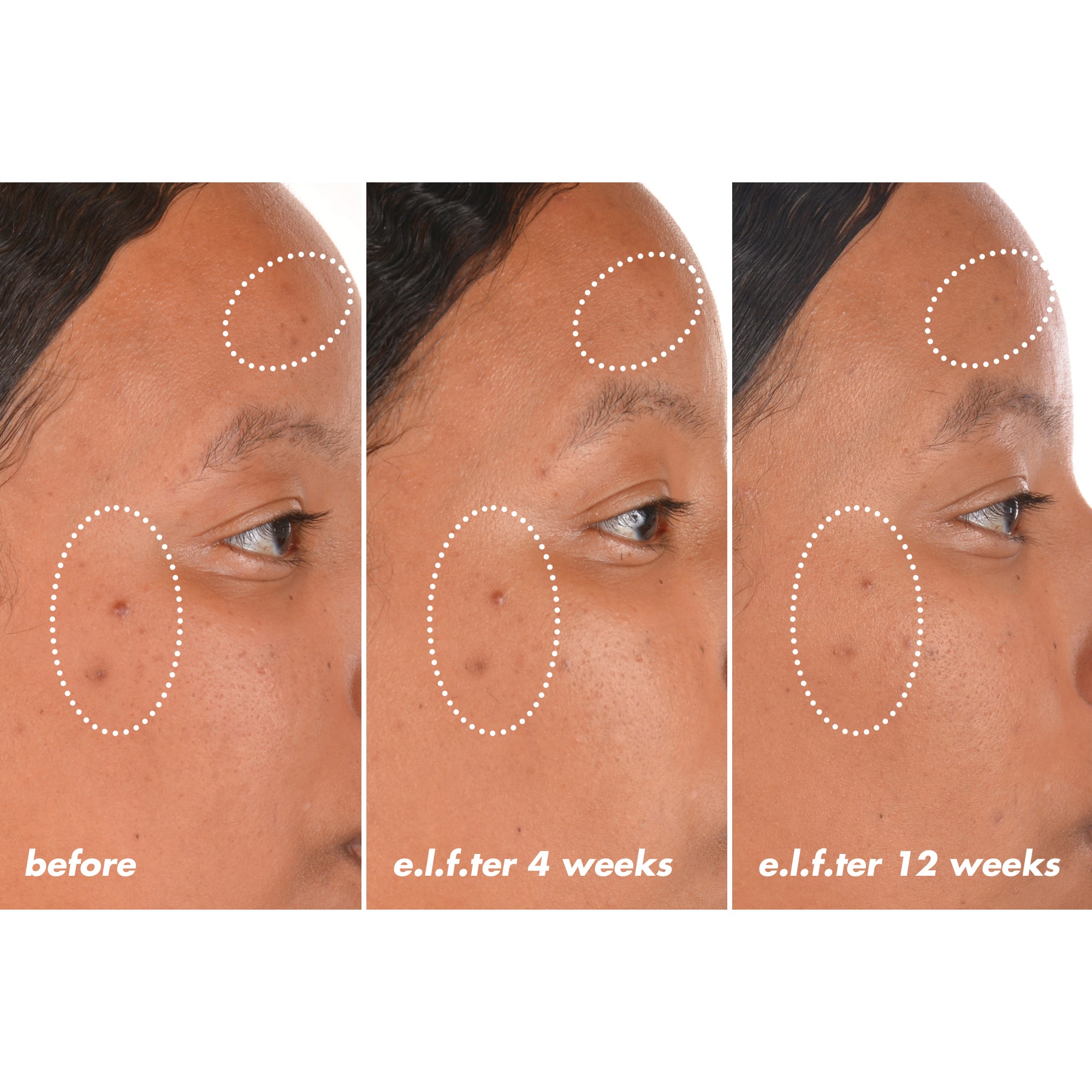 Model Before And After Using Vitamin C Serum